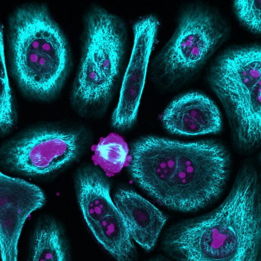 cervical cancer cells imaged with fluorescence microscopy